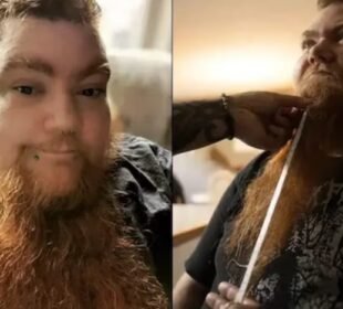 Guinness World Record for longest female 'beard' broken by US Woman | Baaghi TV
