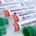 Spread of Monkey pox - A major threat for Pakistan | Baaghi TV